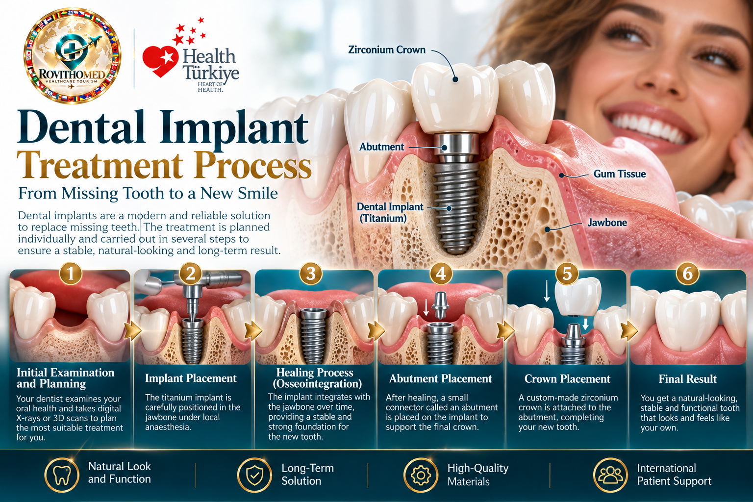 Dental implants treatment in Turkey with zirconium crowns